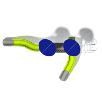 INOX óriás tornyok ferde híddal két csúszdával